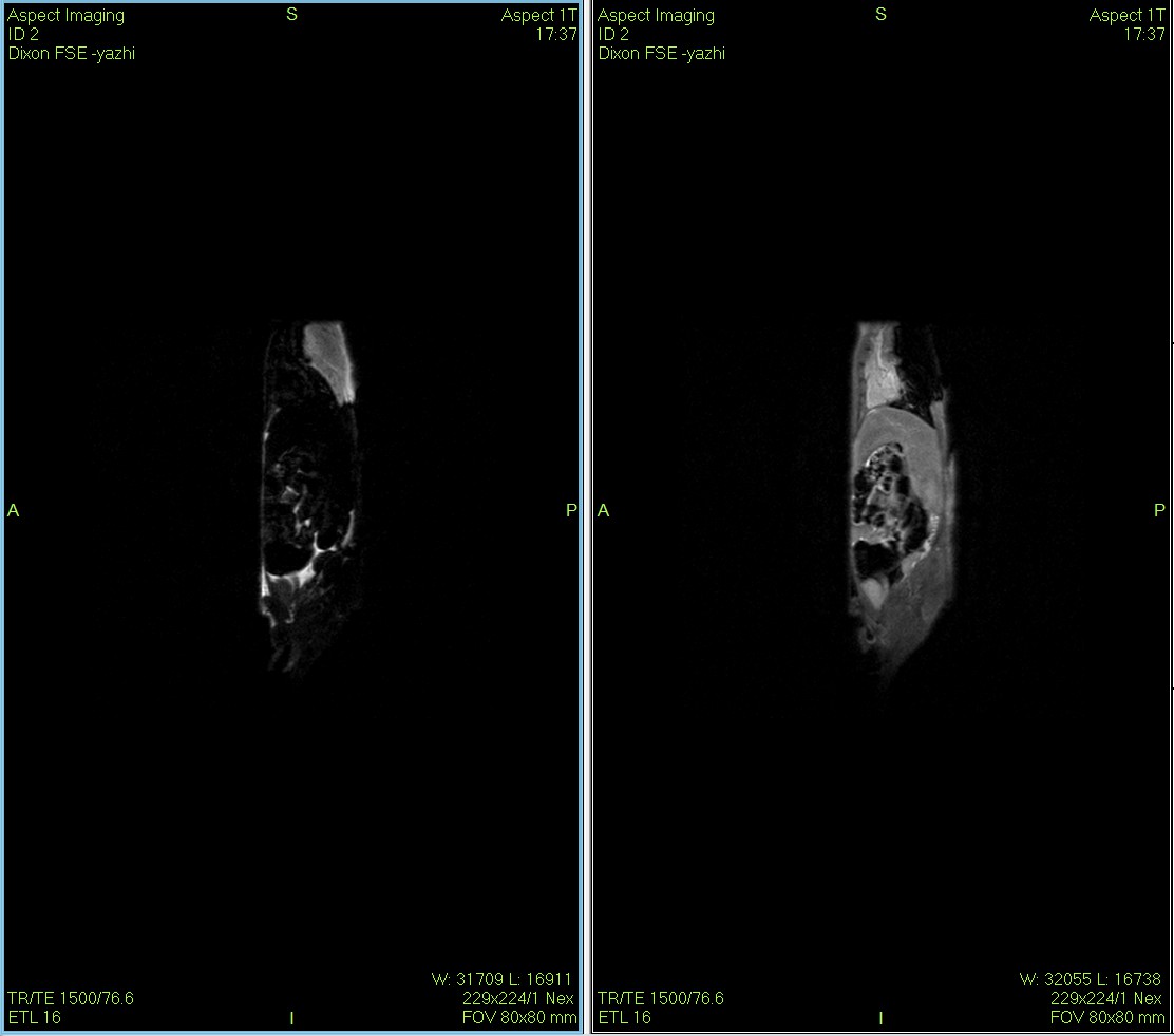 Dixon序列用于大鼠、小鼠水脂分离磁共振成像-脂肪抑制技术